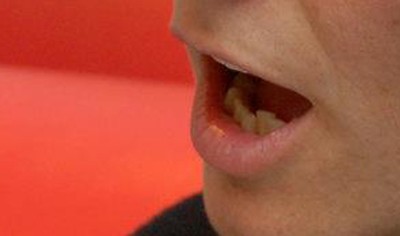 Las estereotipias verbales en personas con daño cerebral adquirido