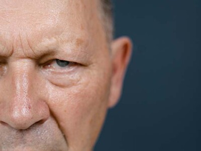 Manejo de las alteraciones cognitivo-conductuales basado en la ética y la dignidad Primer plano de unn hombre mayor enfadado