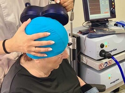 Una terapeuta aplica una estimulador magnético transcraneal sobre la cabeza de una mujer